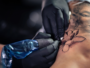 Alergia na Tatuagem